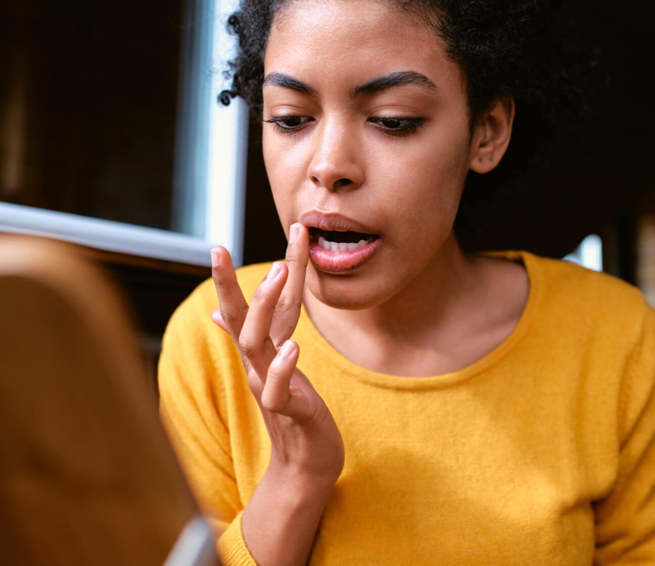 Woman with treated cold sores