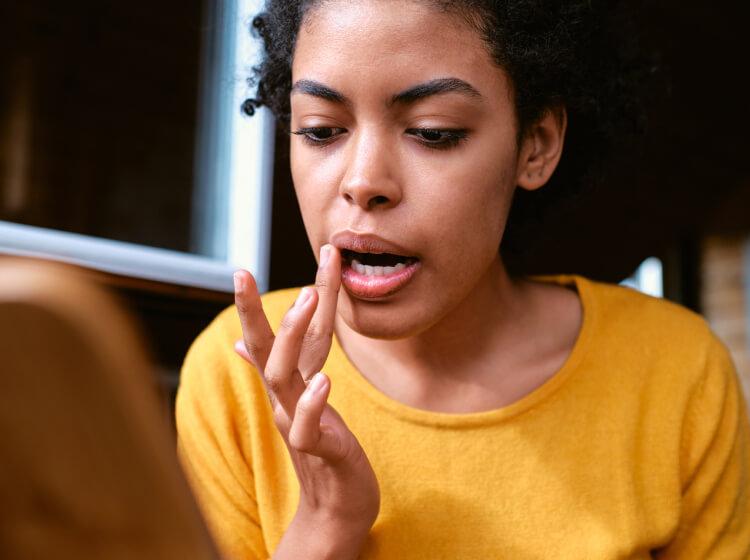 Woman with treated cold sores